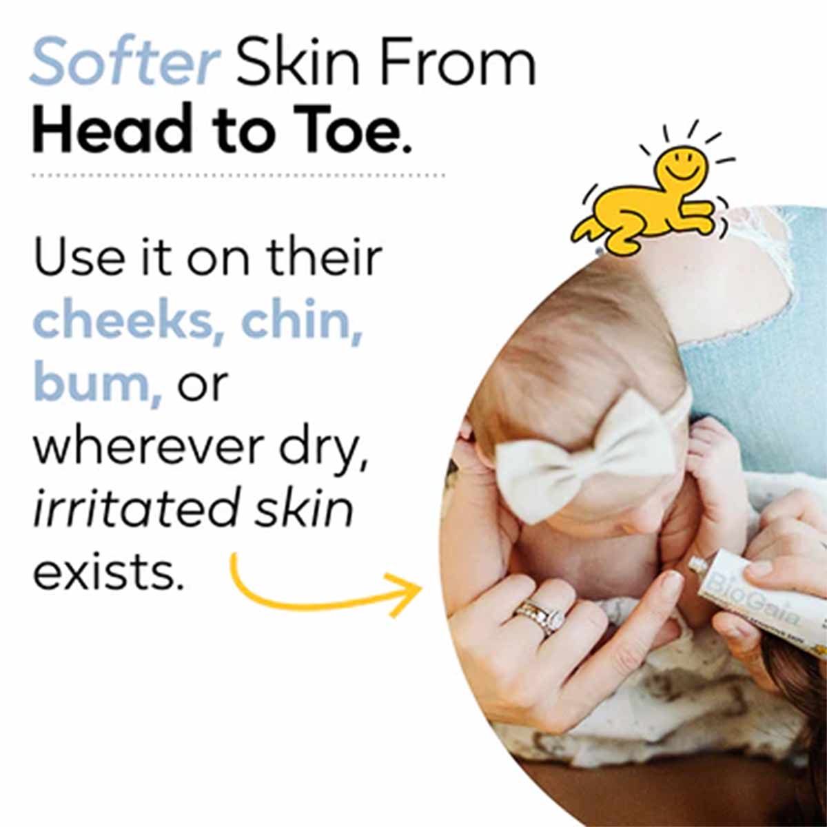 Adult applying white probiotic ointment to baby's cheek with yellow tube visible.