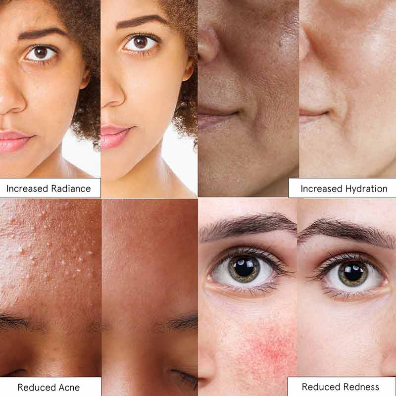 Rose Hydrating Facial Spray, by Grace & Stella, image #5